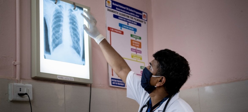 Global progress against tuberculosis is at risk due to lack of funding