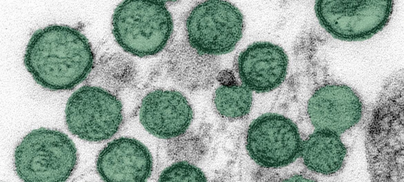 Hantavirus outbreak in the Atlantic: the disease was detected in another passenger